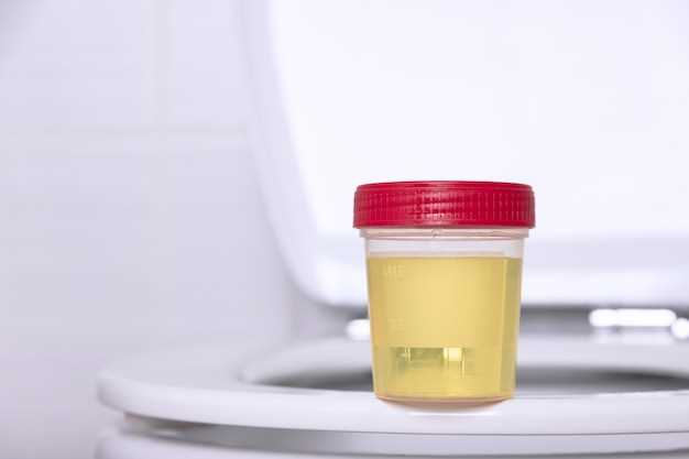 Can tamsulosin cause blood in urine