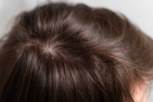 Can tamsulosin cause hair loss