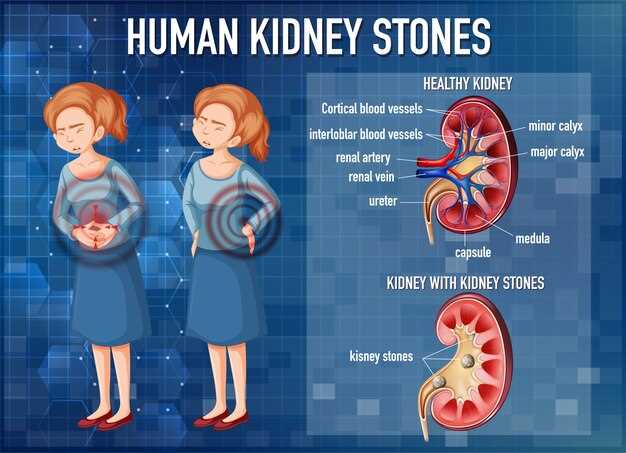 Tamsulosin hcl and kidney stones