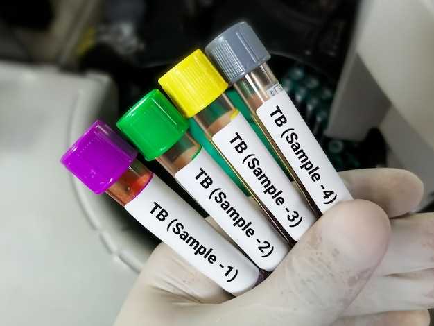 Tamsulosin psa levels