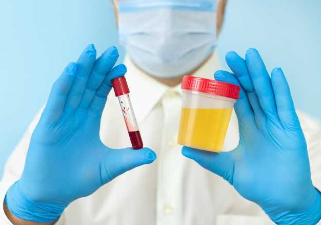 Tamsulosin side effects blood in urine